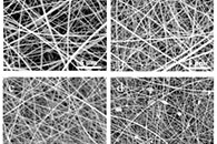 具有改善的生物降解性、抗菌活性和血管生成的仿生SIS基生物复合材料用于腹壁修复