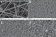 International Journal of Biological Macromolecules：含生物活性pDNA复合物的电纺明胶基质