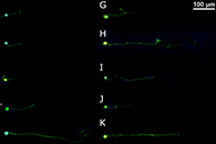 J.Biomed.Mater.Res.：肝素-透明质酸纳米纤维用于在脊髓修复中隔离生长因子