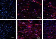 Cells：两种不同直径的定向电纺PLGA纤维用于肌腱再生