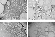 Int. J. Biol. Macromol.：含香脂木豆精油的电纺聚乙烯醇/壳聚糖纳米纤维的制备及应用