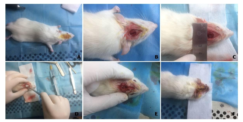 BMP-2/IGF-1-SF/P(LLA-CL)同轴静电纺丝屏障膜成骨性能研究