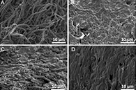 J. Membr. Sci.：表面功能化PVDF电纺纳米纤维增强的季铵化壳聚糖复合膜用于碱性直接甲醇燃料电池