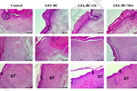 Eur. Polym. J.：便携式电流体动力枪制备的格列本脲和二甲双胍负载细菌纤维素/明胶纳米纤维用于糖尿病患者创伤修复的比较