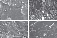 Macromolecular Bioscience：电纺聚己内酯纳米纤维和DSC交联海藻酸钠水凝胶构成的双层圆柱导管，可桥接周围神经间隙