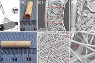 复旦大学洪涛&王春生Materials & Design：一种用于血管组织工程的双层抗凝血管状支架