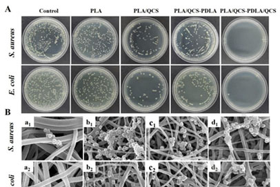 贵州大学何敏&四川大学郭刚Carbohydrate Polymers：含聚乳酸改性季铵化壳聚糖的立体复合电纺纳米纤维，可用于伤口愈合