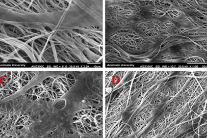 Biochemical and Biophysical Research Communications：hsa-miR-9-1过表达对结膜间充质干细胞在3D纳米纤维支架上光感受器分化的影响