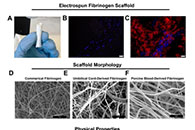 Journal of Tissue Engineering and Regenerative Medicine：使用电纺纤维蛋白原和聚己内酯复合支架制备小儿血源弹性血管移植物