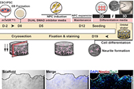 杜克-新加坡国立大学医学院李曾Biomater. Sci.：基于微纤维支架的阿尔茨海默氏病体外3D人类神经元培养模型