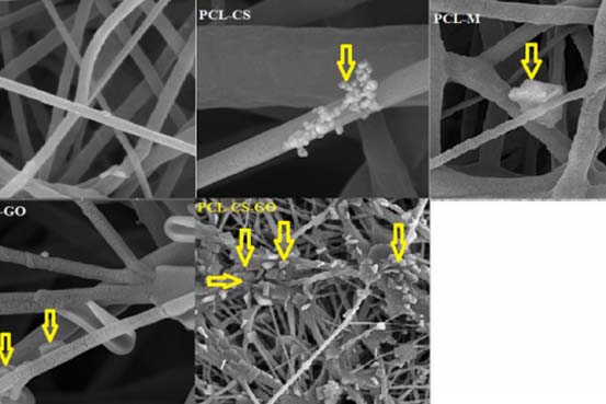 Int. J. Biol. Macromol.：壳聚糖和谷维素涂覆聚己内酯纳米纤维用作治疗感染伤口的新型敷料