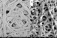 Nanoscale Adv.：电纺永久性超疏水-亲水聚合物纳米复合纤维毡用于高效集雾器