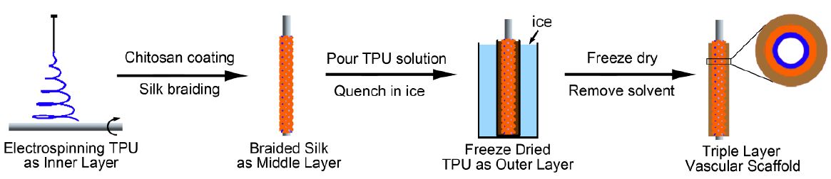 静电纺丝/蚕丝编织与相分离法结合制备三层结构血管支架