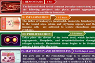 Pharmaceutics：基于多糖的生物聚合物电纺纳米纤维用于伤口愈合管理