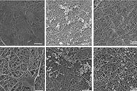 ACS Appl. Mater. Interfaces：聚酰胺纳米纤维形态对细菌生物膜形成的影响