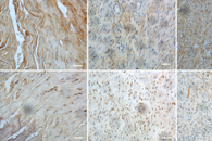 南通大学袁卉华&东华大学张彦中Int. J. Biol. Macromol.：仿生COL1-CS/PLLA纤维的制备及其在肌腱组织再生中的应用