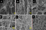 Int. J. Biol. Macromol.：几丁质基纳米纤维的制备及其在防治植物病害中的应用