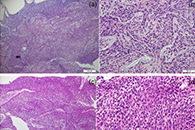 J. Biomed. Mater. Res. Part A：PCL-蛋白质杂化纳米纤维支架的静电纺丝制备及其在骨骼肌组织工程中的应用