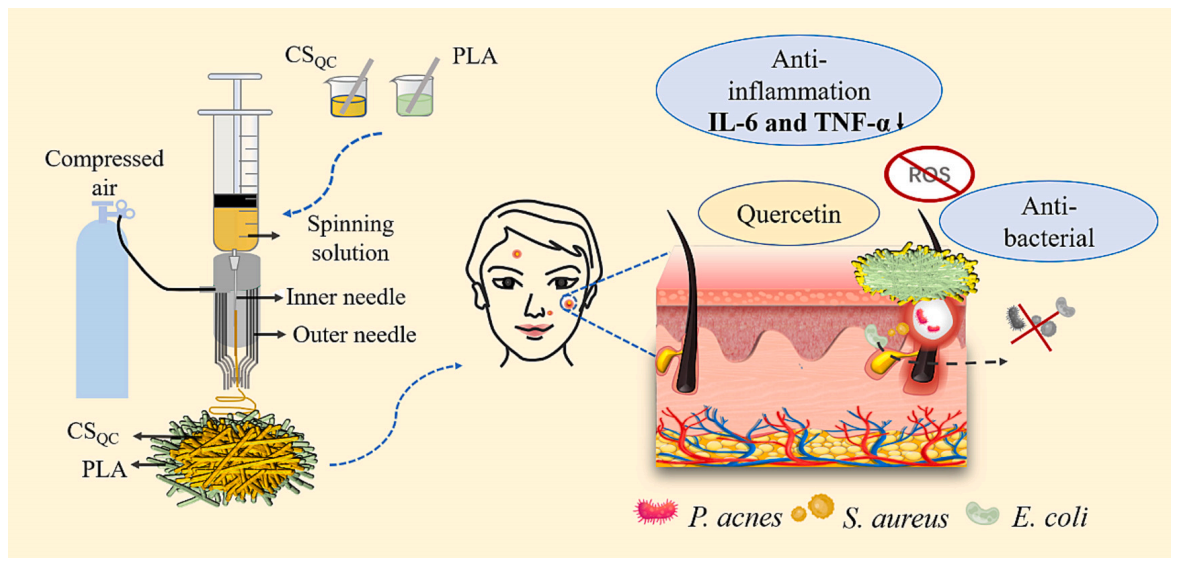 青岛大学陈为超&李纪伟Carbohydr. Polym.：具有抗菌抗炎特性的溶液吹纺双层壳聚糖/聚乳酸纳米纤维贴片，可加速痤疮愈合