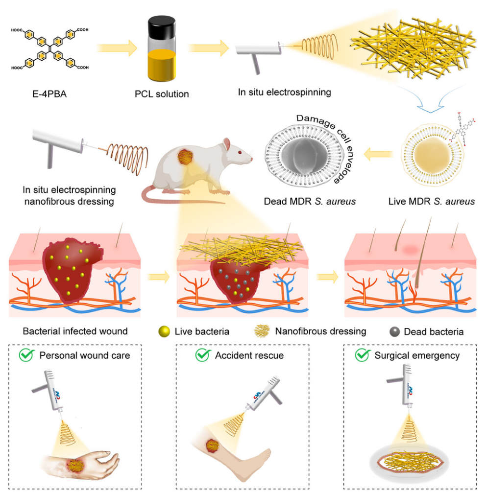 南方科技大学蒋兴宇教授&青岛大学龙云泽教授：一种含有多臂抗生素的原位敷料，用于治疗不规则伤口