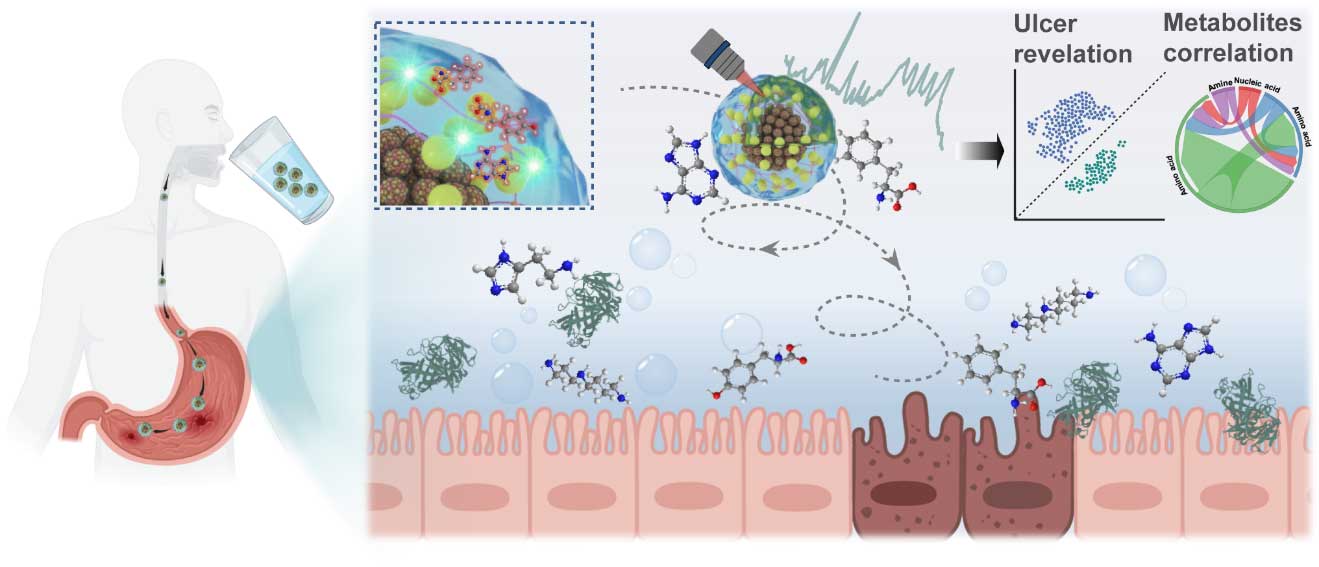 湖南大学陈卓教授Biomaterials：同轴静电纺丝开发磁等离子体系统，实现胃溃疡诊断