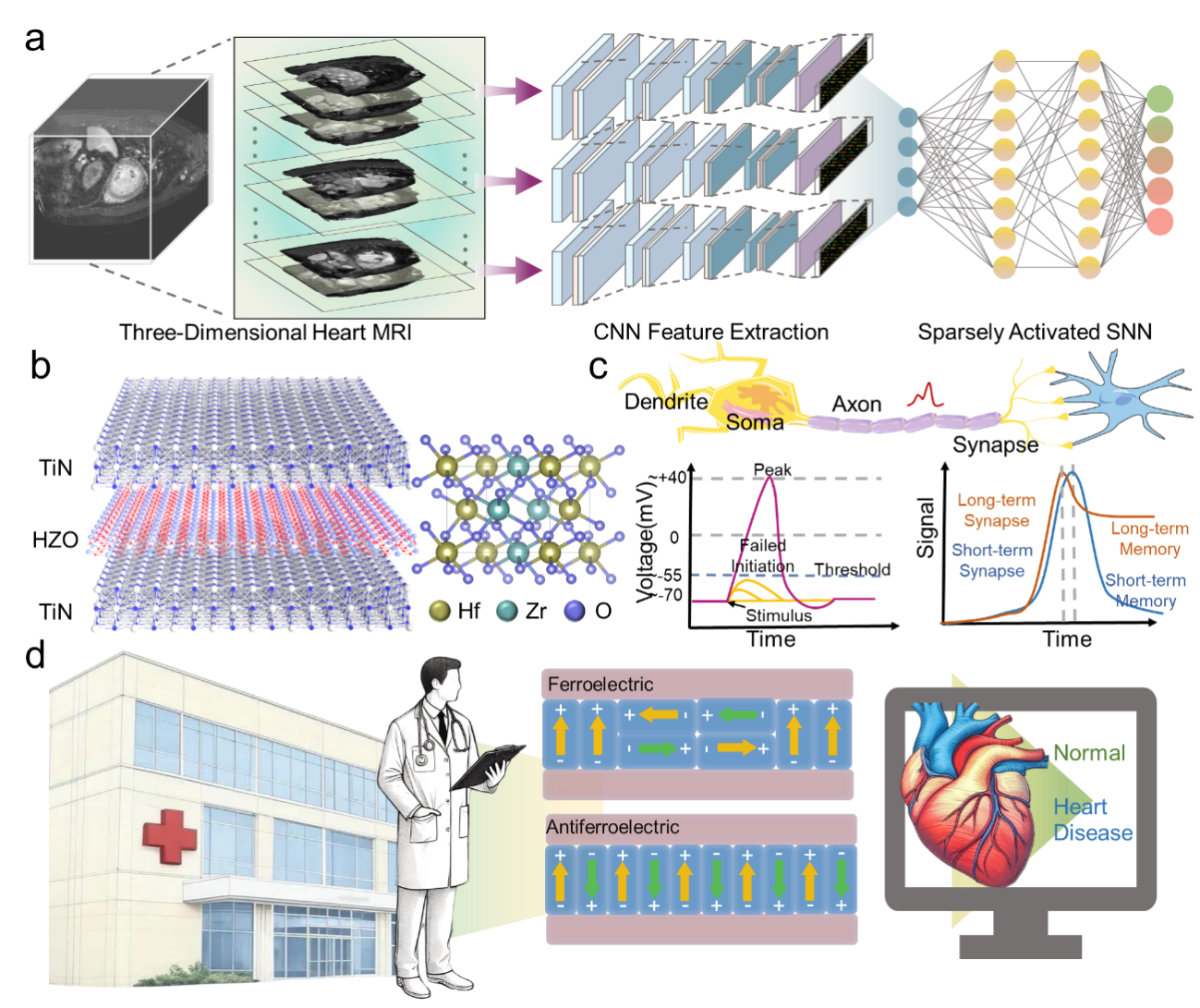 复旦大学陈琳教授、山东大学王天宇、孟佳琳教授Nano Letters:类脑器件新进展:铁电/反铁电芯片赋能心脏影像AI识别诊疗