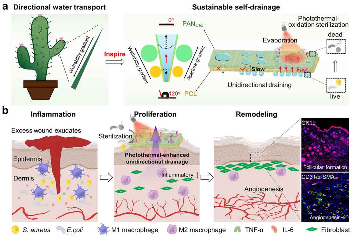 东华大学陈志钢教授Nano-Micro Letters：仙人掌刺启发的 Janus 纳米纤维膜，用于光增强糖尿病伤口愈合